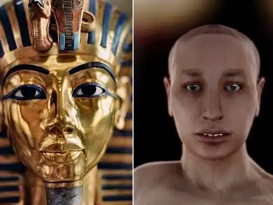 King Tut Opium theory connected to Tutankhamun chronic pain